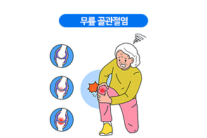 무릎 골관절염